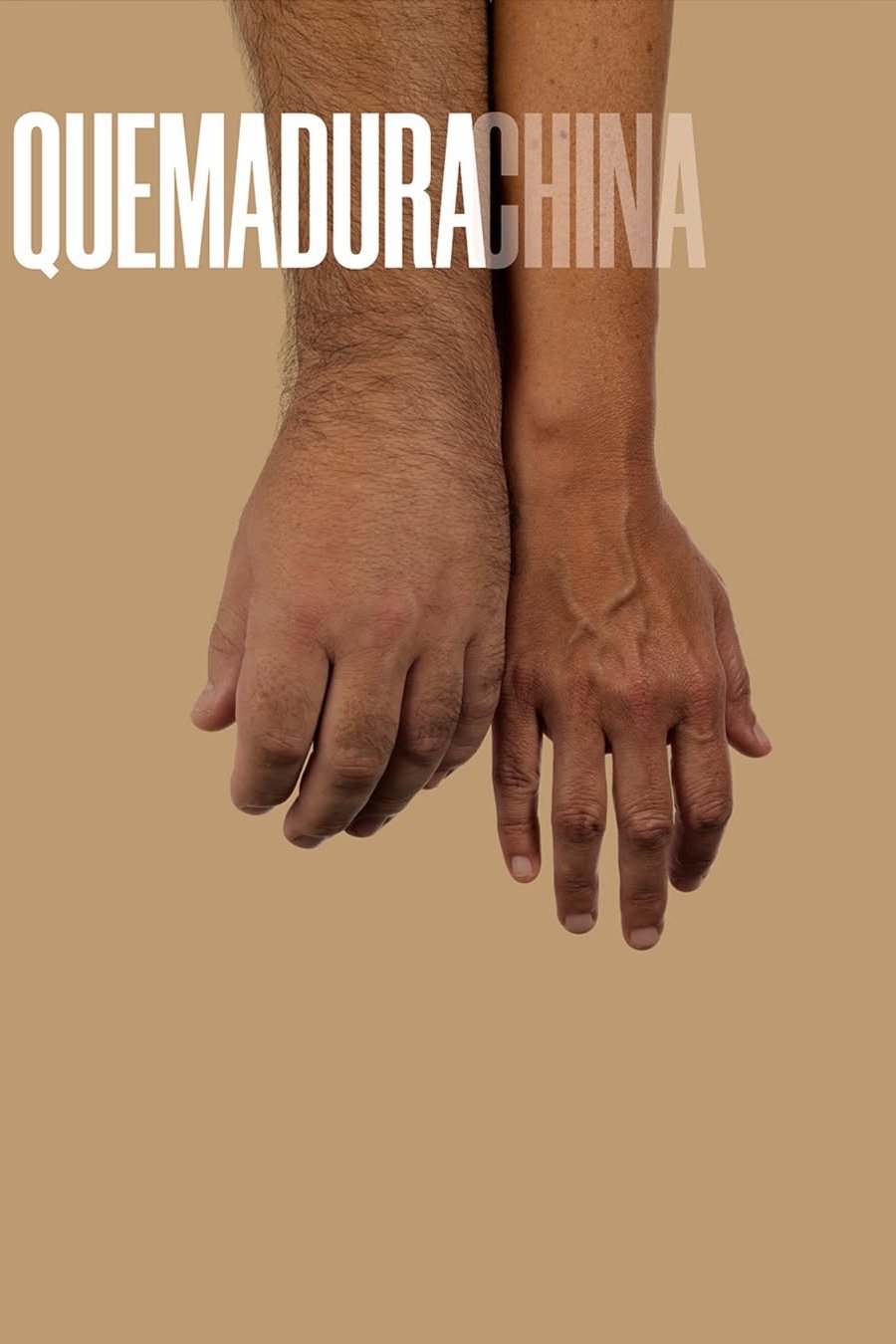 Quemadura China