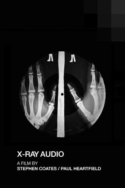 X-Ray Audio